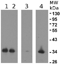 eEF1B-alpha2 | elongation factor 1B-alpha 2 in the group Antibodies Plant/Algal  / DNA/RNA/Cell Cycle / Translation at Agrisera AB (Antibodies for research) (AS10 679)